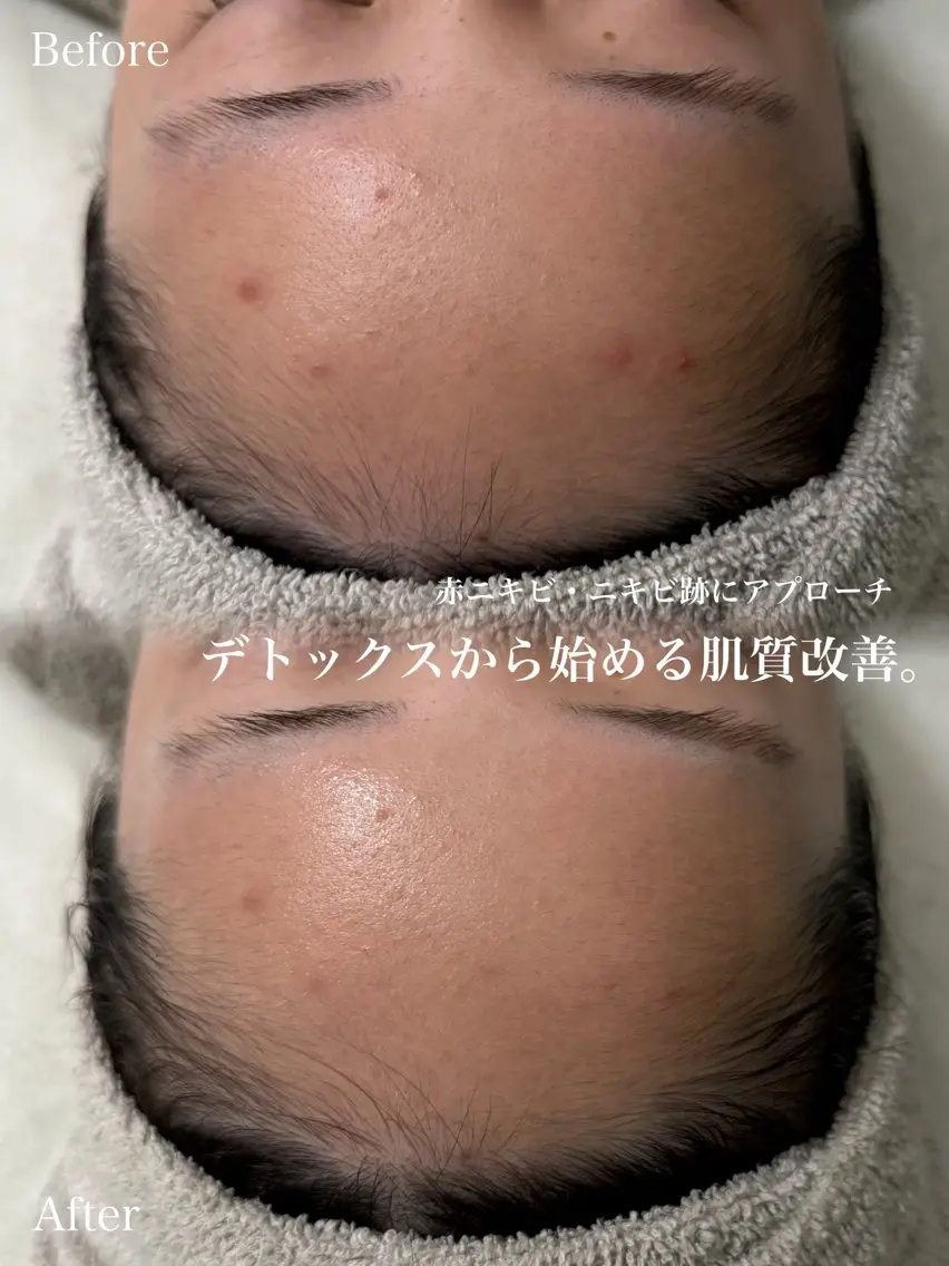 エステ SALON el KARINのエステ・リラクイメージ
