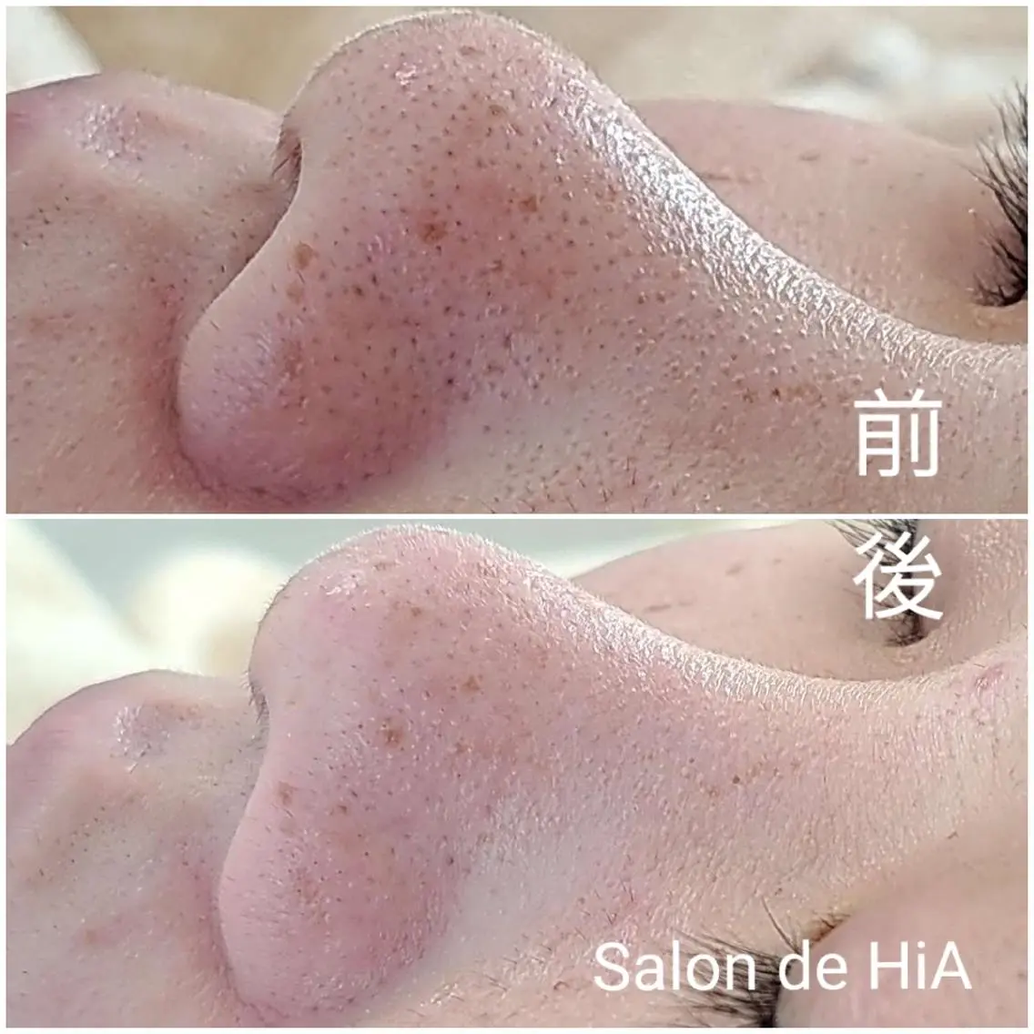 エステ Salon de  HiAのエステ・リラクイメージ