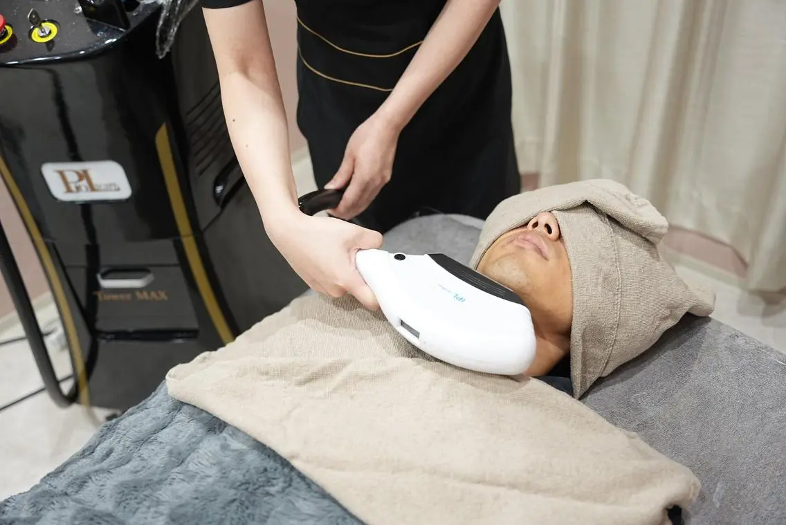 【メンズ人気No.1💆‍♂️】気になる産毛・髭とはおさらば👋顔まるごと脱毛（首まで）5,000円の写真