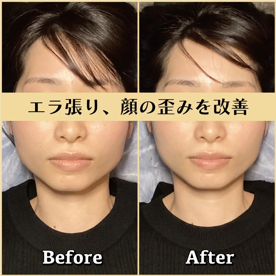 エステ リラク 歪み専門💫筋膜整体 はたやまきんま君💪のエステ・リラクイメージ