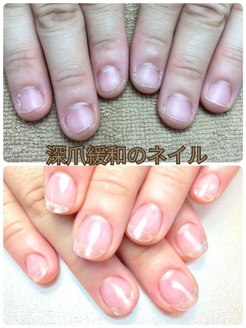 ネイル 長さ出し ジェルネイル 春ネイル ハンドネイル ハンドケア 深爪矯正/爪育成ケア manie nailのネイルデザイン