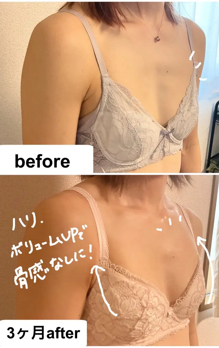 エステ 育乳痩身バストアップ サロン　つばききよらのエステ・リラクイメージ
