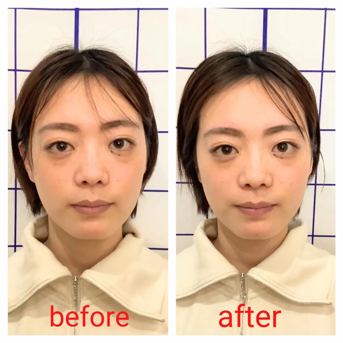 お顔のむくみたるみ 専門☆美容鍼小顔矯正のエステ・リラクイメージ