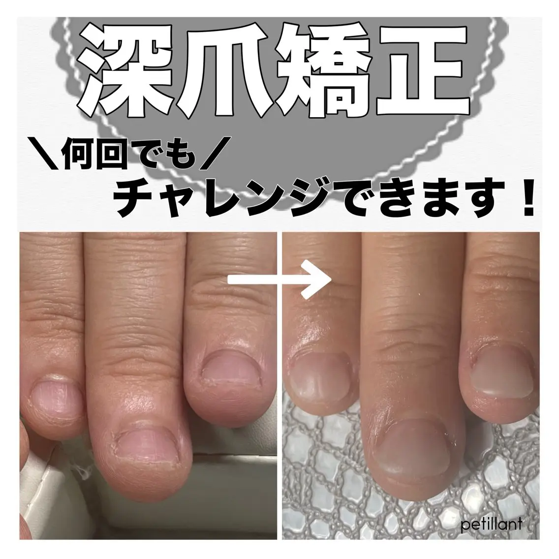 ネイル ハンドネイル ハンドケア nail salon petillantのネイルデザイン