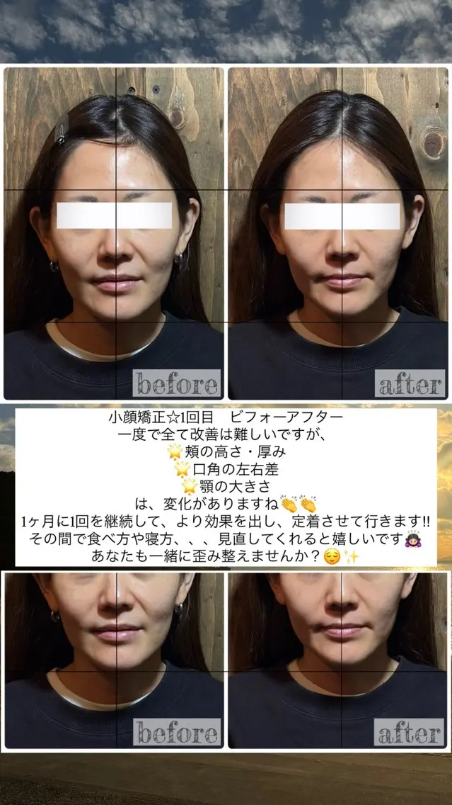 💎後悔させない小顔 矯正💎イトヤマ🌱のエステ・リラクイメージ