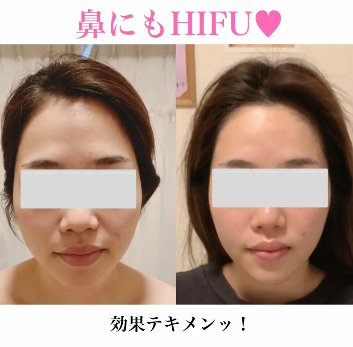 a room salonのエステ・リラクイメージ