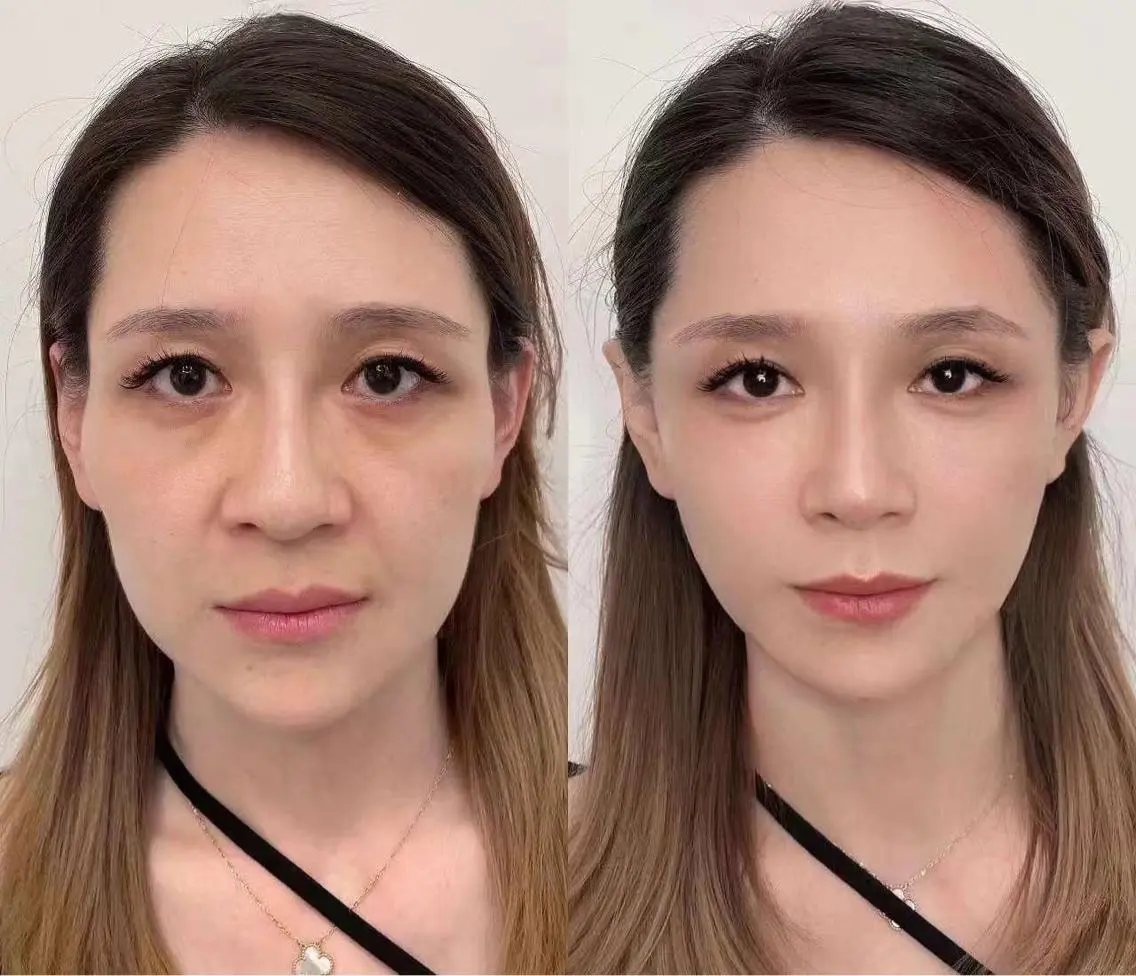 ネイル マツエク・マツパ ブルー 赤色 aliaハーブ水光店 エステティシャン募集のエステ・リラクイメージ