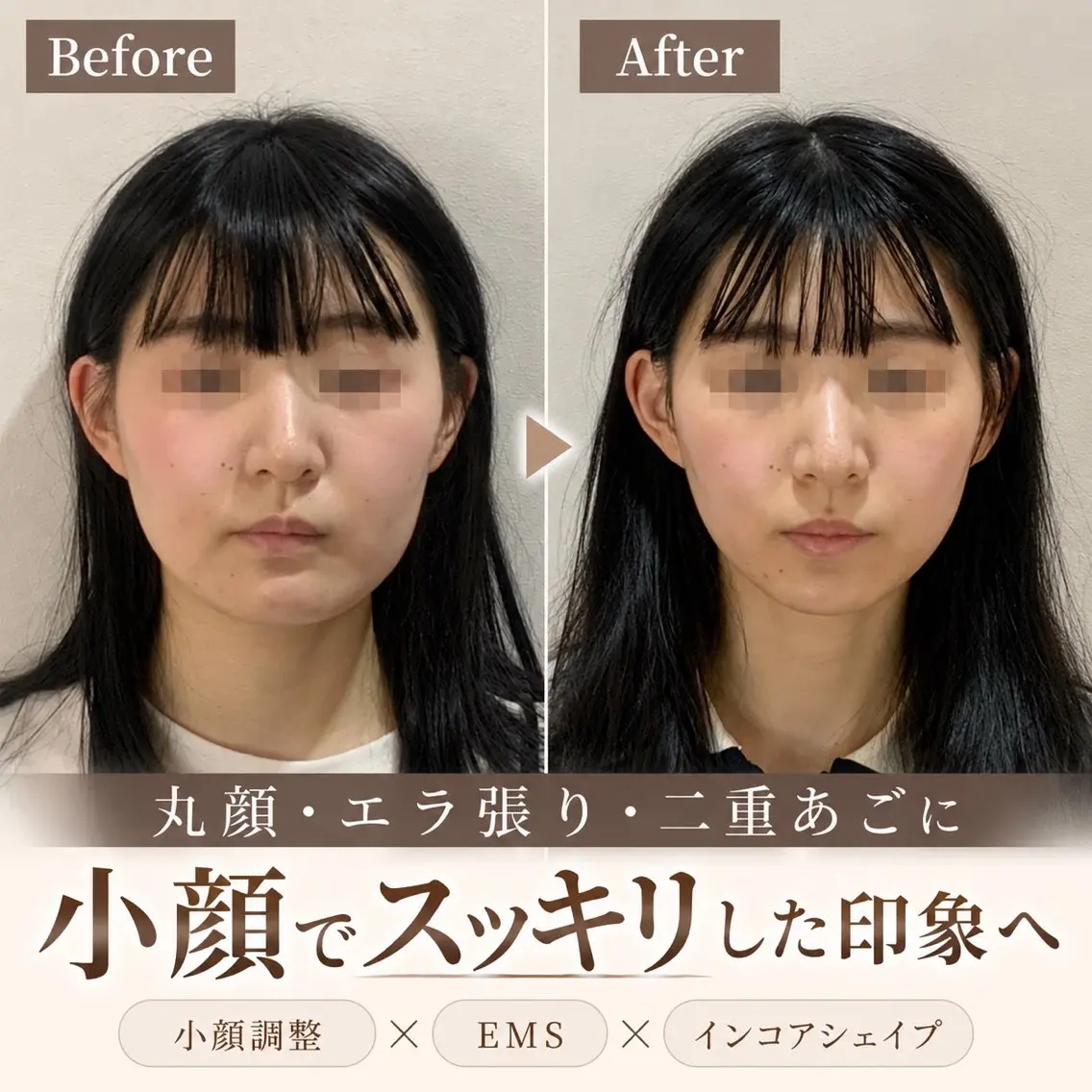 エステ リラク 最速小顔・肌質管理 espoirマキのエステ・リラクイメージ