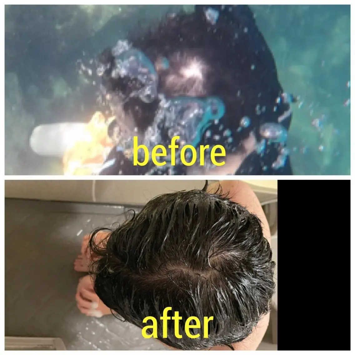 薄毛改善ヘッドスパの写真
