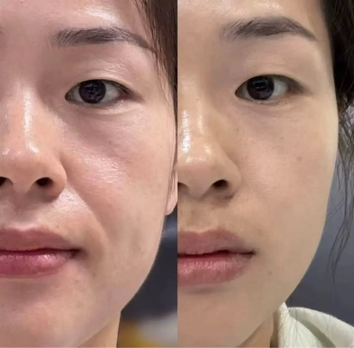 マツエク・マツパ エステ 愛維美水光専門店 川崎彩鳳のエステ・リラクイメージ