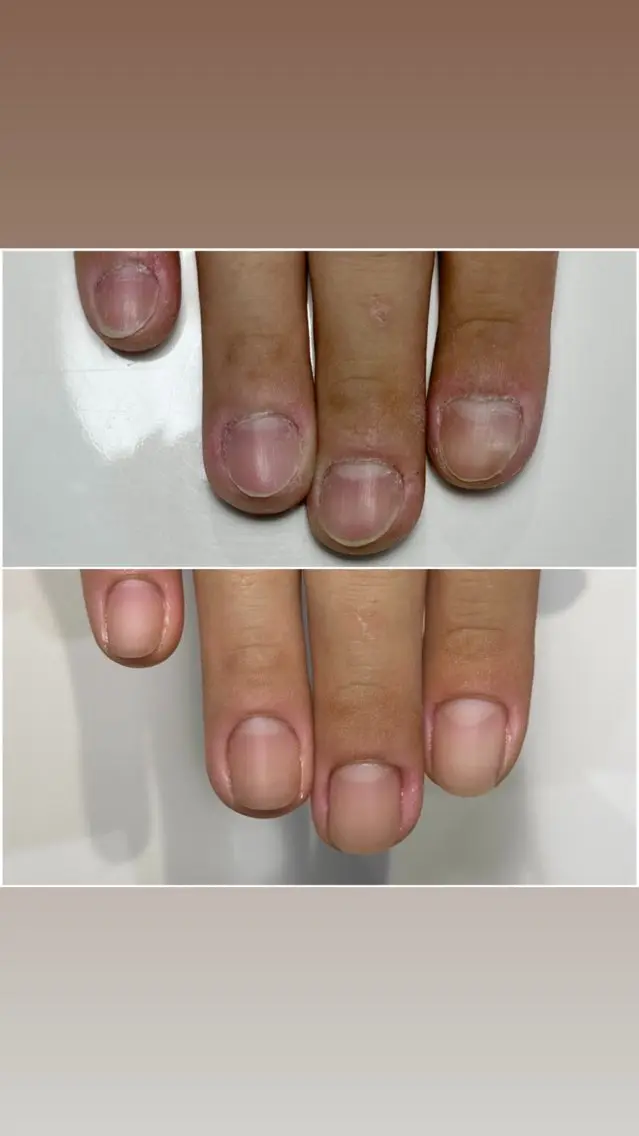 ネイル 雀宮 自爪育成 Re.nail〜寺本のネイルデザイン