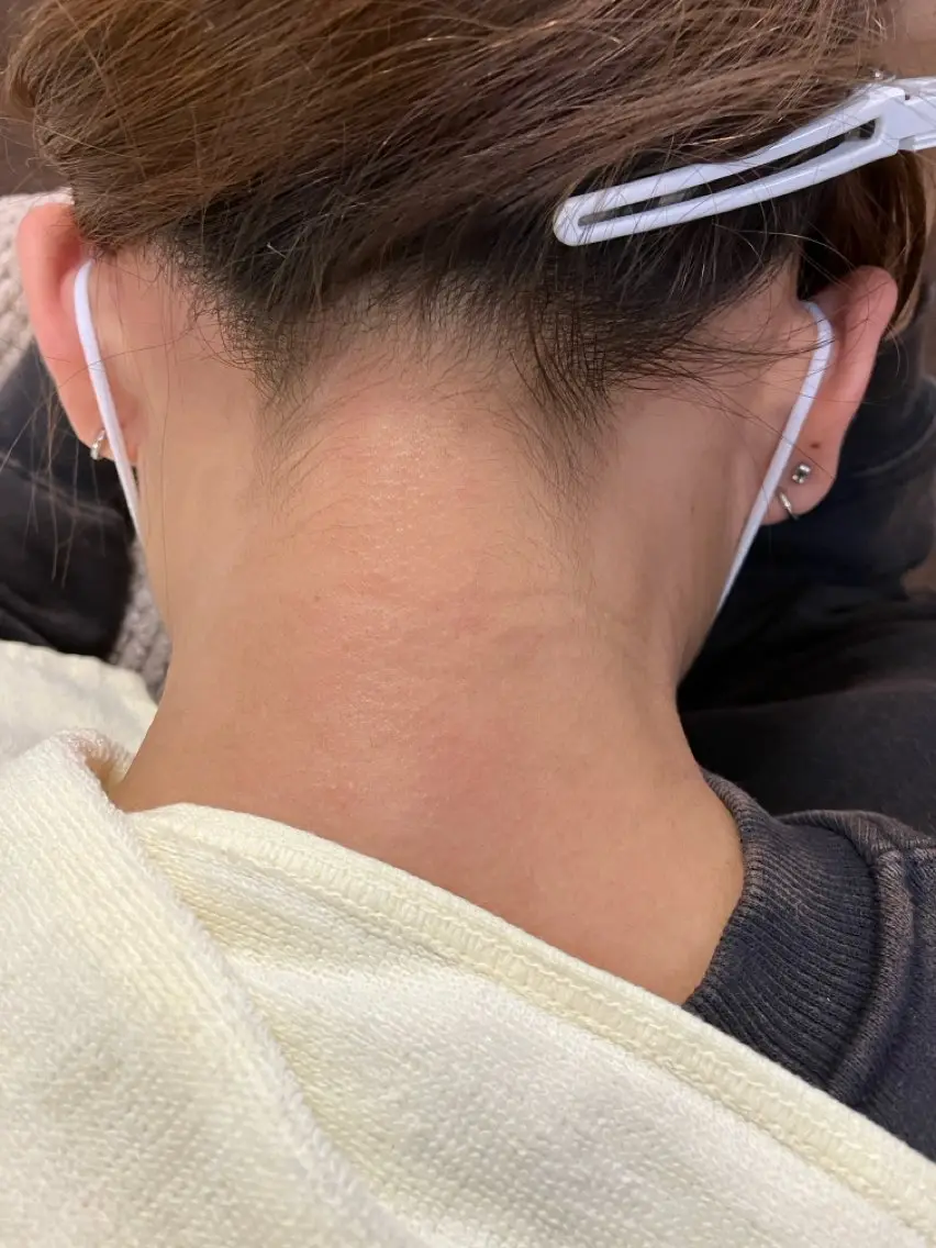 脱毛 caresalon callaのエステ・リラクイメージ