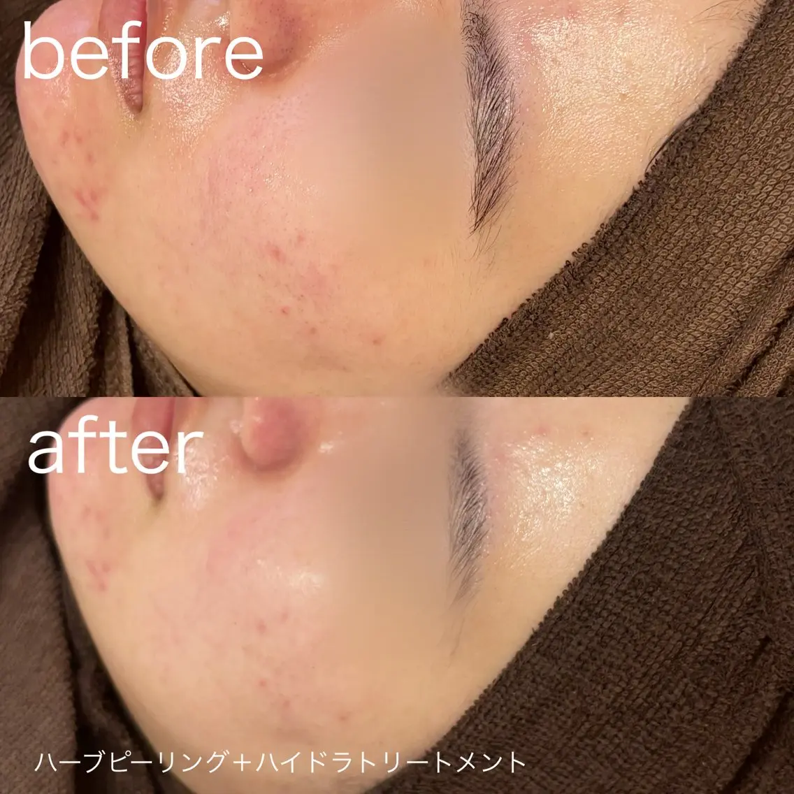 脱毛 lulula ricoのエステ・リラクイメージ