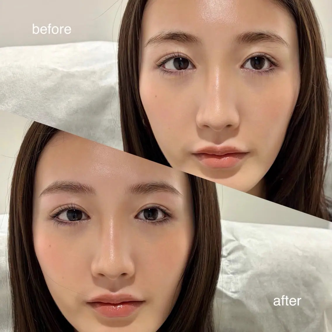【📷お顔フル撮影可能モデル】【🔴眉のお手入れを1ヶ月半以上していない方】(wax・間引き) 当店での施術が初めての方の写真
