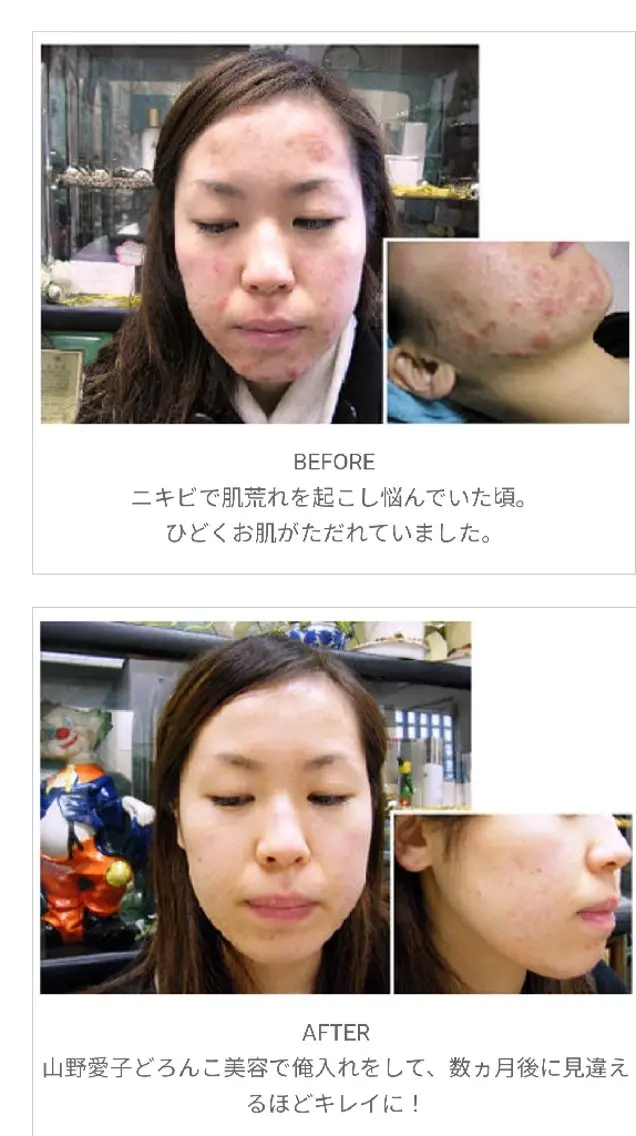 エステ 山野愛子どろんこ美容 Laughのエステ・リラクイメージ