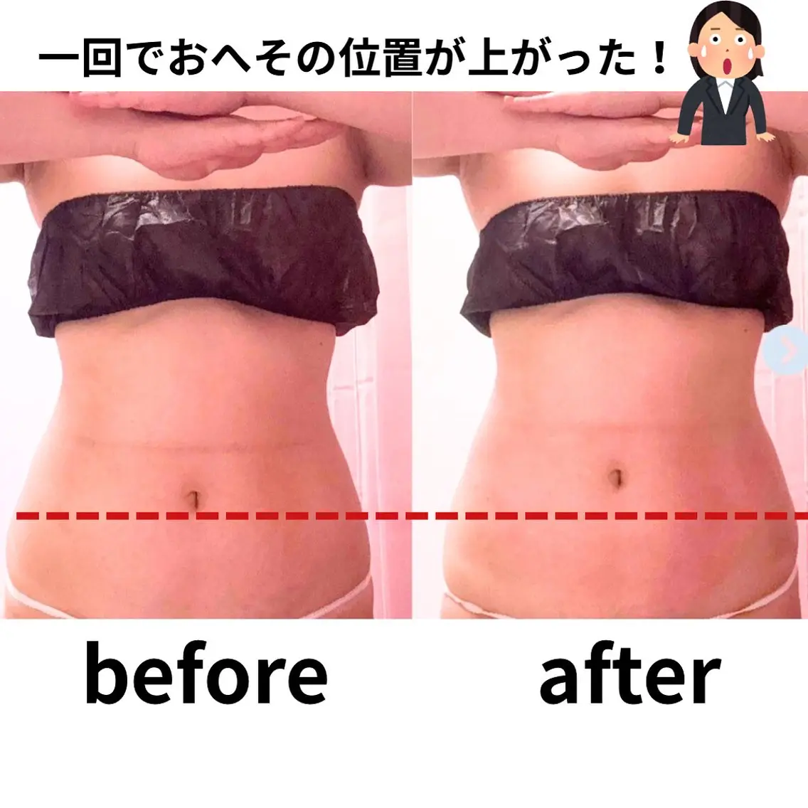脱おは体型へ【ぽっこりお腹/下腹】たるみ卒業痩身60分¥14,000→8.980の写真