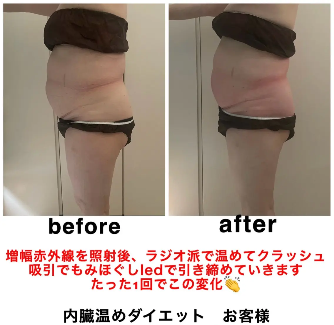 エステ ネイル・エステサロン UILANIのエステ・リラクイメージ
