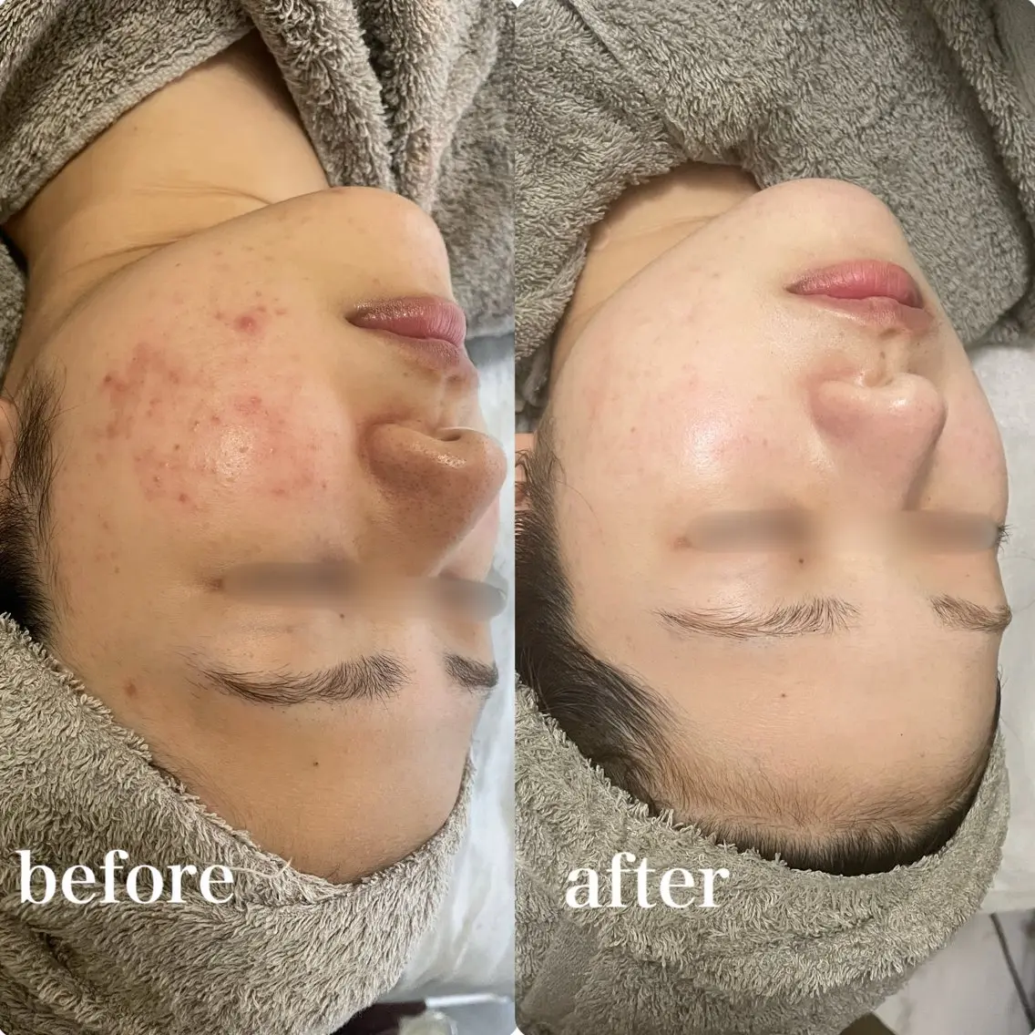 エステ SALON el 歯と肌の専門店のエステ・リラクイメージ