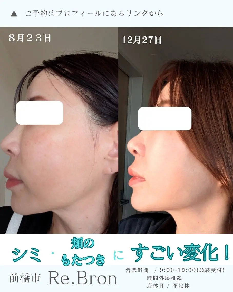 エステ リラク たるみ・ くすみ シミ・ニキビ肌改善のエステ・リラクイメージ