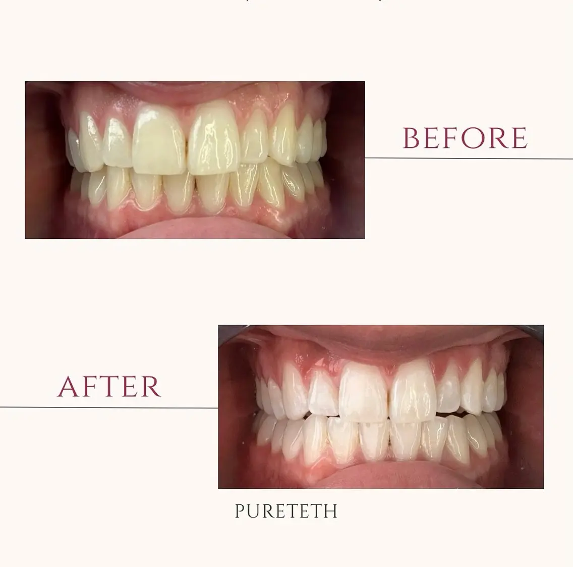 その他 ホワイトニングサロン PURETETHのエステ・リラクイメージ