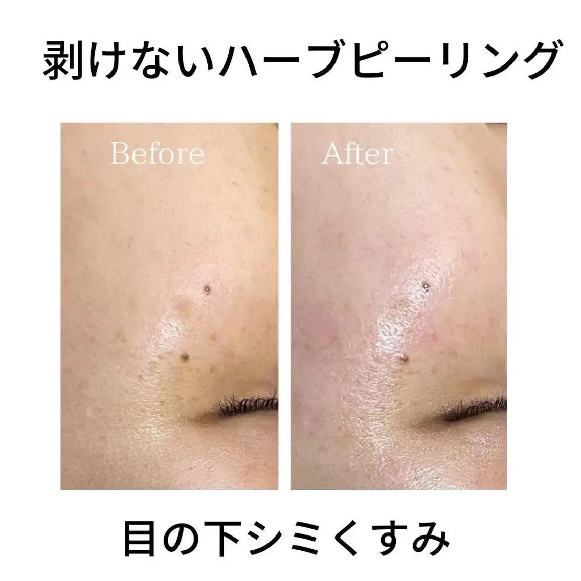N  eye beauty高丘のマツエク・マツパデザイン