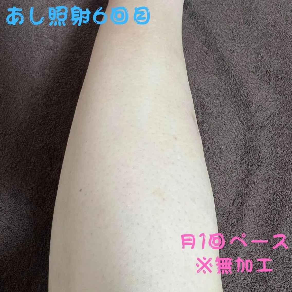 メンズ キッズ 脱毛 メンズ脱毛フェリッセ /男女🆗キッズ🆗のエステ・リラクイメージ
