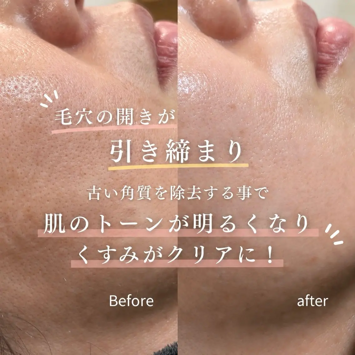 エステ Balance facialのエステ・リラクイメージ