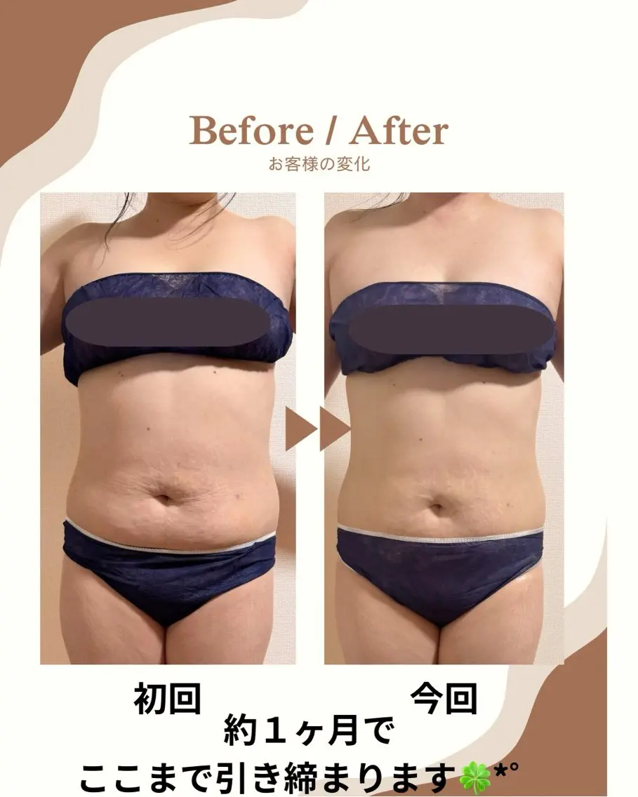 エステ BeutySalon ERIKAのエステ・リラクイメージ