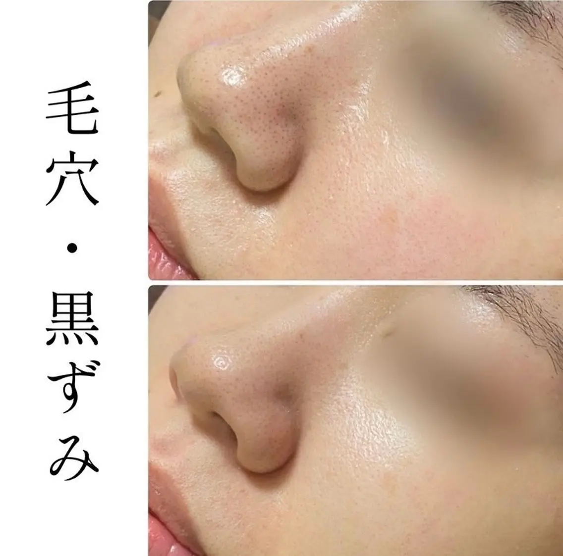 ハーブピーリング専門 BIOPLUS+川崎のエステ・リラクイメージ