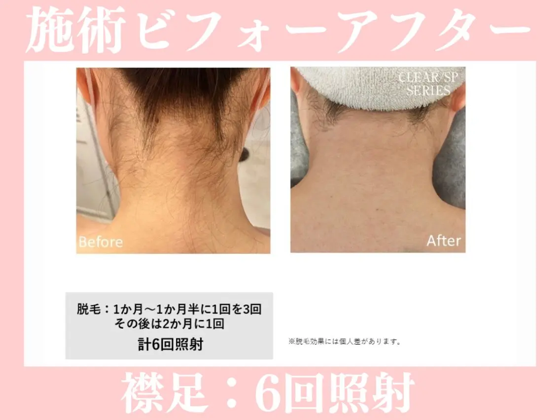 脱毛 beauty SalonRcoinのマツエク・マツパデザイン
