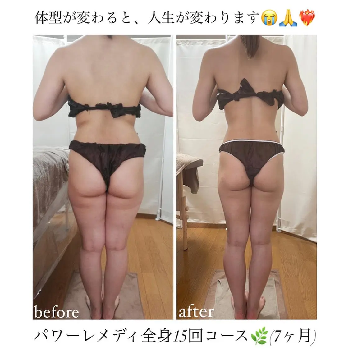 《本気痩せ×疲労改善 》 BILOOPのエステ・リラクイメージ