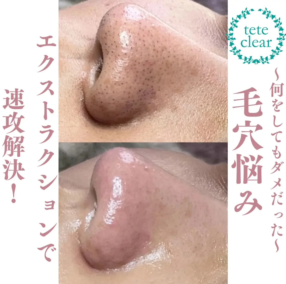 エステ beauty salonWのエステ・リラクイメージ