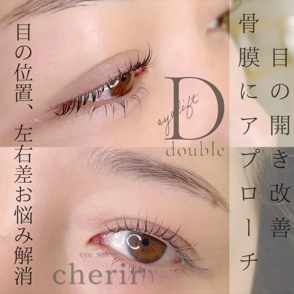 【ご新規様限定 minimo価格】浮腫・眼精疲労にも効果的のアイストレッチ込み✨ダブルアイリフト✨の写真