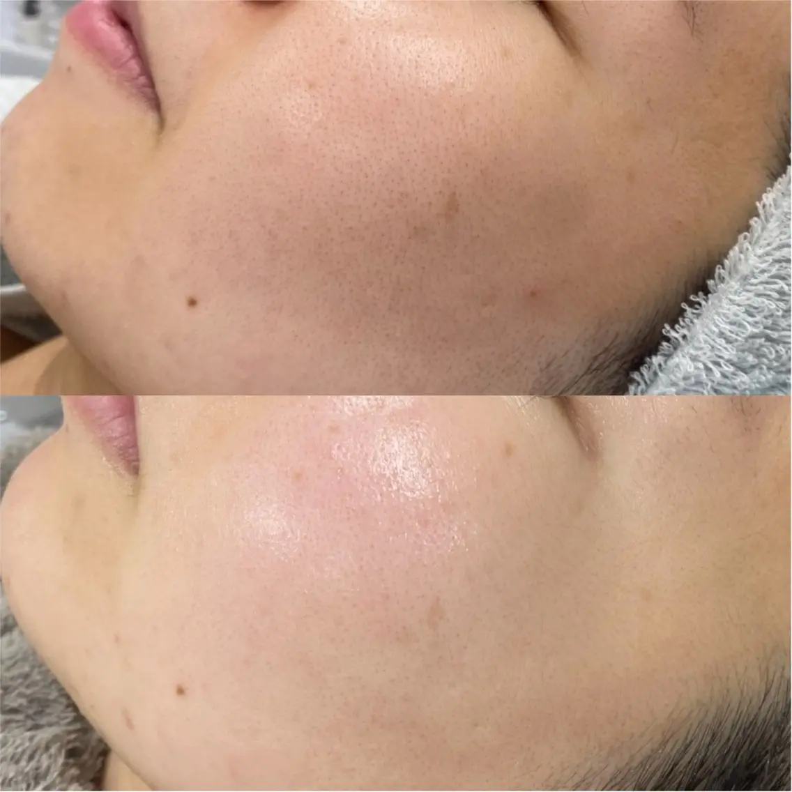 エステ CE salon Eulunaのエステ・リラクイメージ