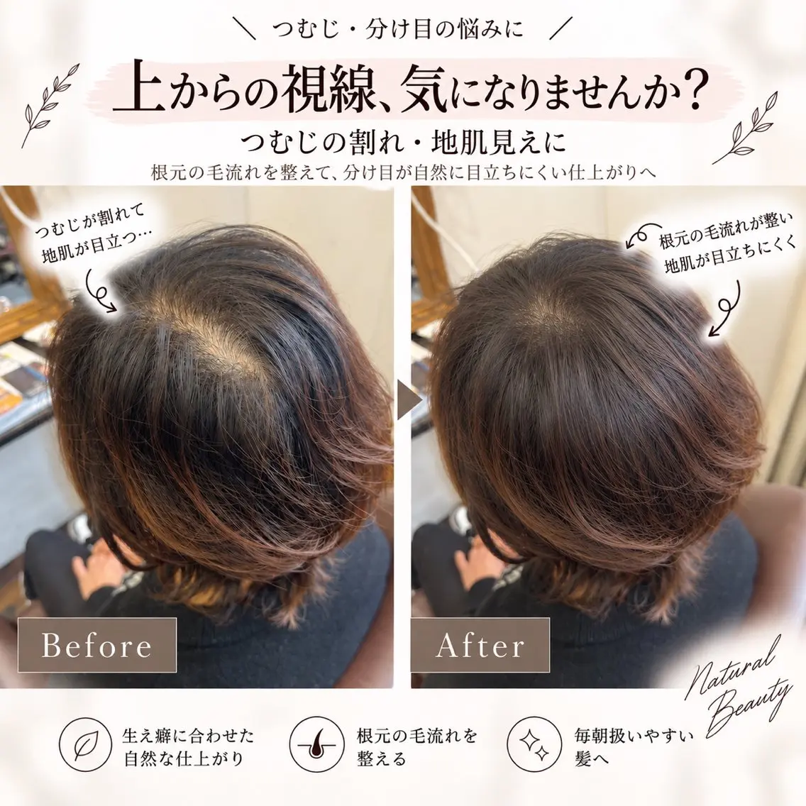 【モデル募集🌿】つむじ・前髪の割れに｜生え癖矯正1箇所の写真