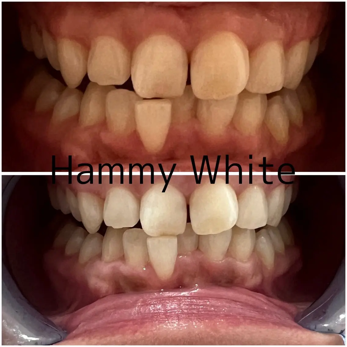 その他 HammyWhite 心斎橋🌈AMIのその他イメージ