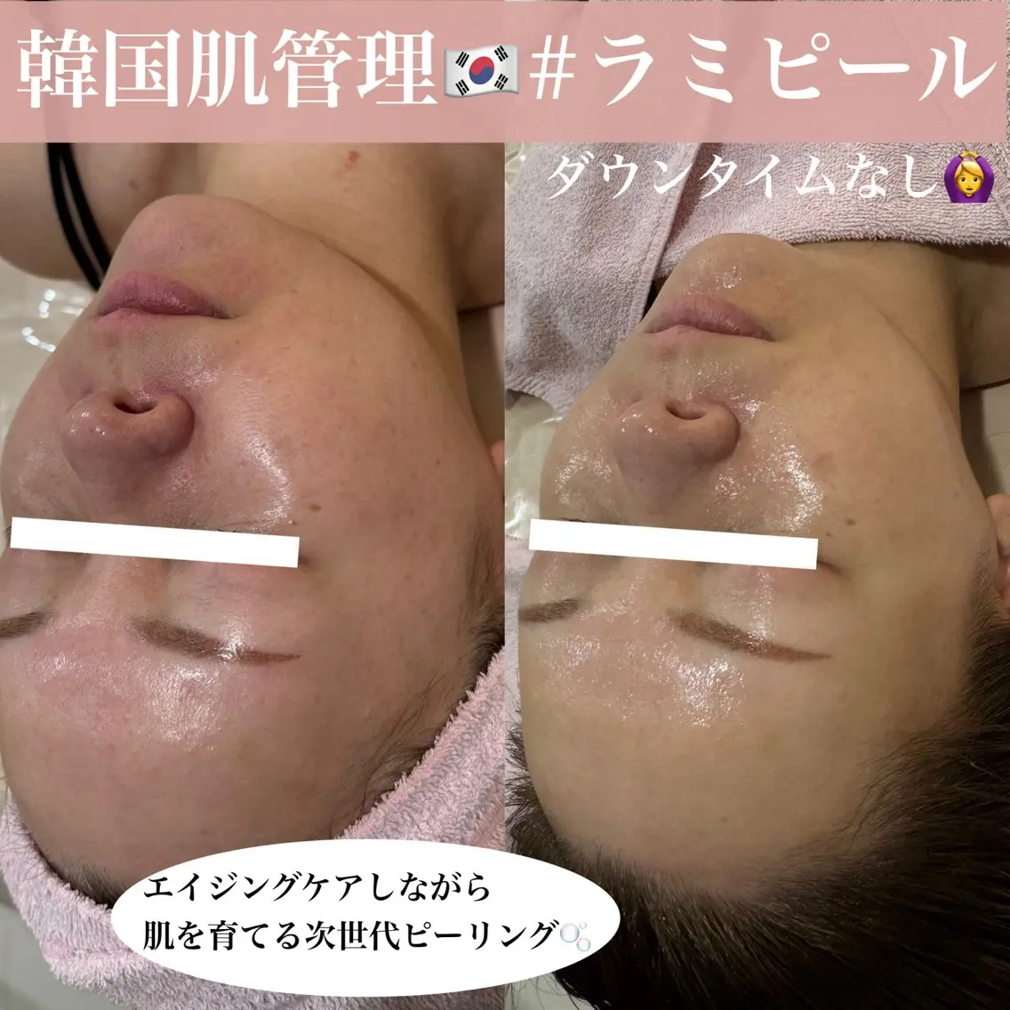 salondeBe 🩵フェイシャル専門のエステ・リラクイメージ