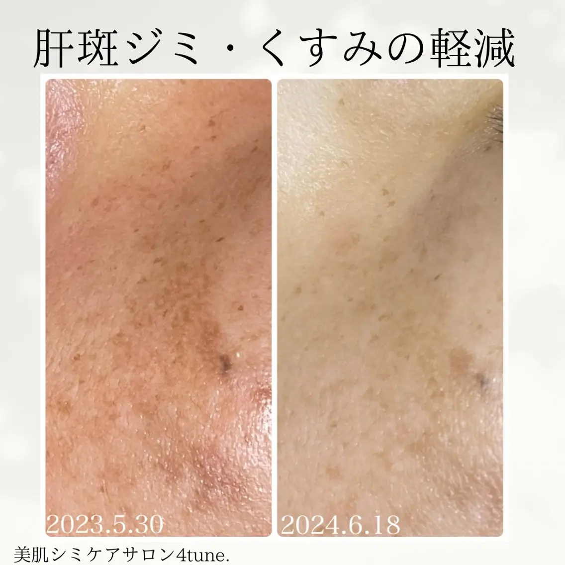 美肌シミケアサロン 4tune.RUMIのその他イメージ
