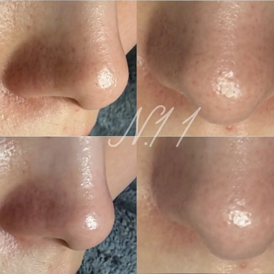 beauty salonN.11のエステ・リラクイメージ