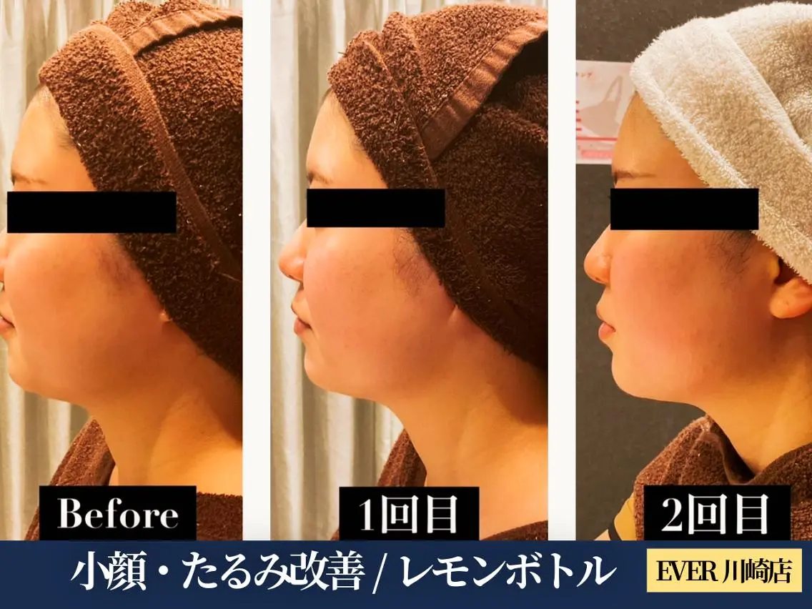 エヴァーグレース 川崎店のエステ・リラクイメージ