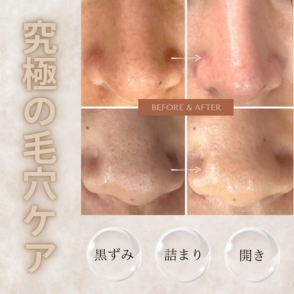 エステ 肌質改善専門サロン Bellmi/心斎橋のエステ・リラクイメージ
