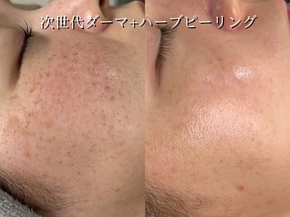 エステ Rairy Salon富士見町のエステ・リラクイメージ