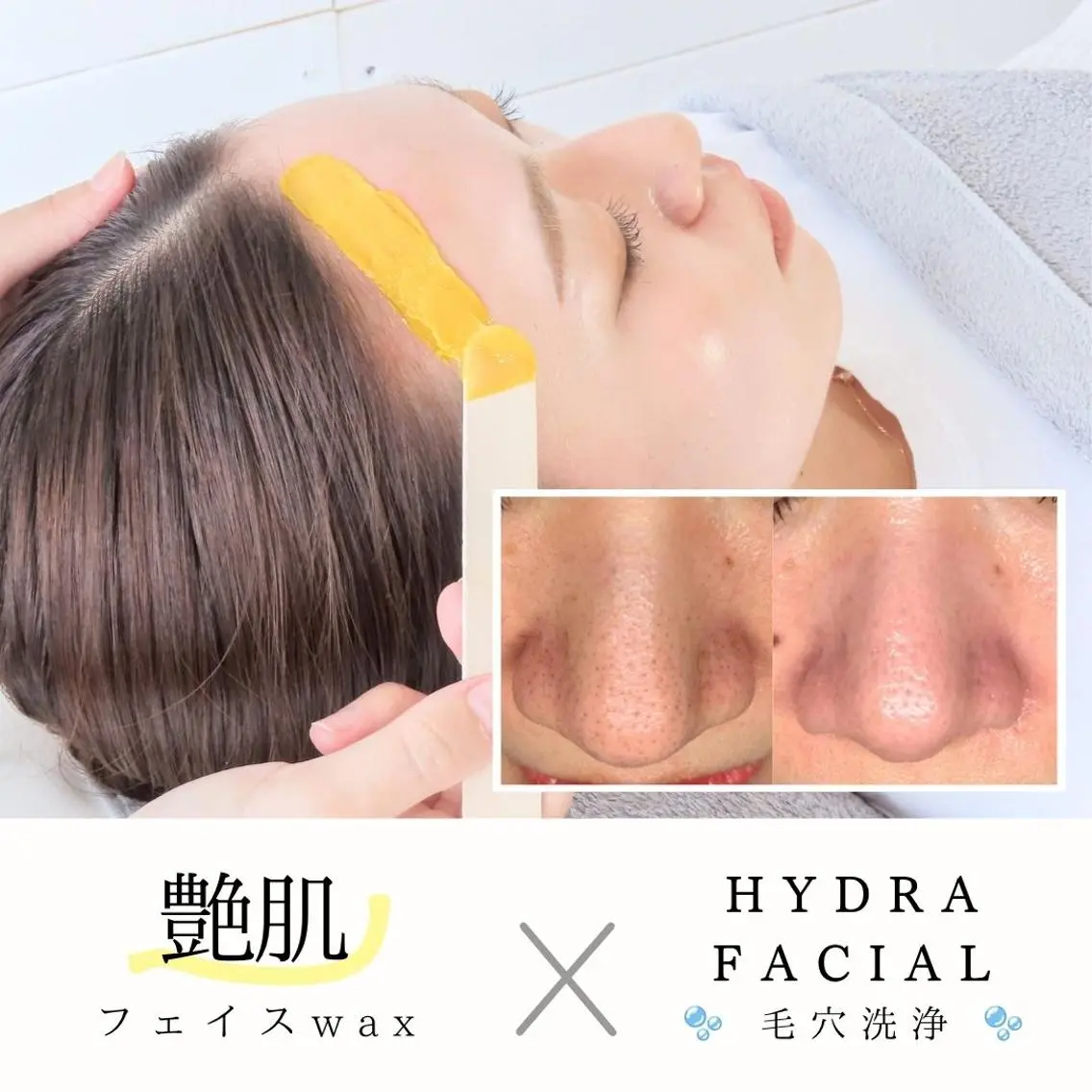 🤍くすみ・化粧ノリ・即効性🤍毛穴洗浄〔鼻単品〕× 艶肌フェイスワックス🤍 初回¥8,300(メンズ＋1000円)の写真