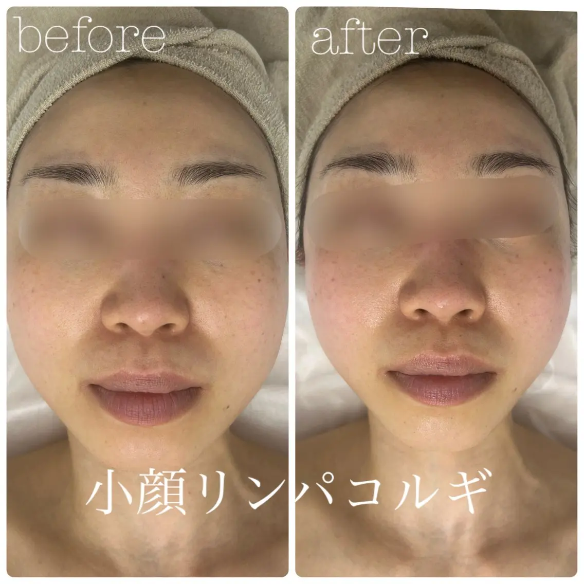 フェイシャルサロン CHIARA 荒田のエステ・リラクイメージ