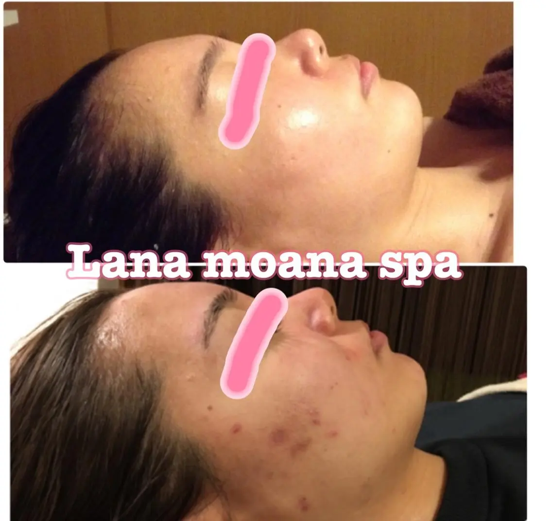 Lana moana spa🌺のエステ・リラクイメージ