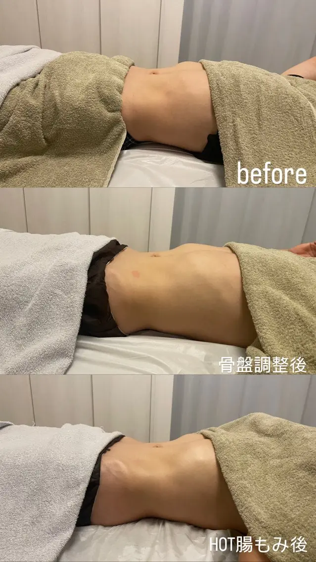 ウエストすっきり◎めっちゃ出る💩お腹痩せダイエッ【HOT腸もみと骨盤調整50分】の写真