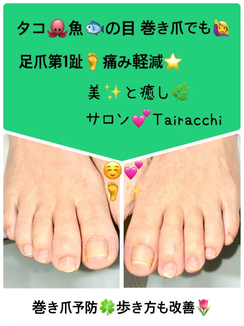 ネイル フットネイル フットネイル Tairacchi タイラッチのエステ・リラクイメージ