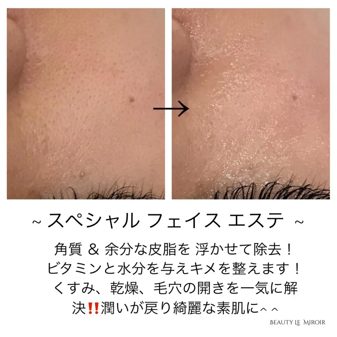 ビューティー ミロワールのエステ・リラクイメージ
