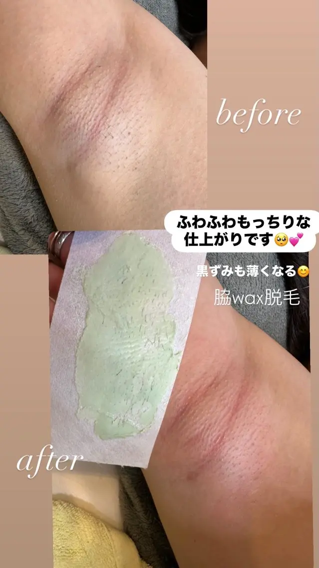 脱毛 Re.lien 白子菜美のエステ・リラクイメージ