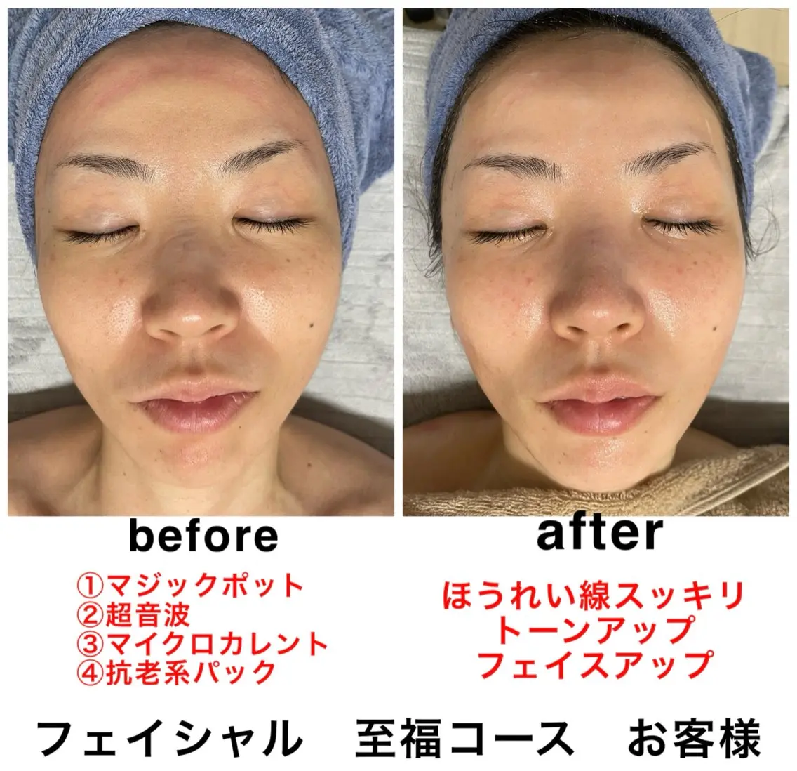 ネイル・エステサロン UILANIのエステ・リラクイメージ